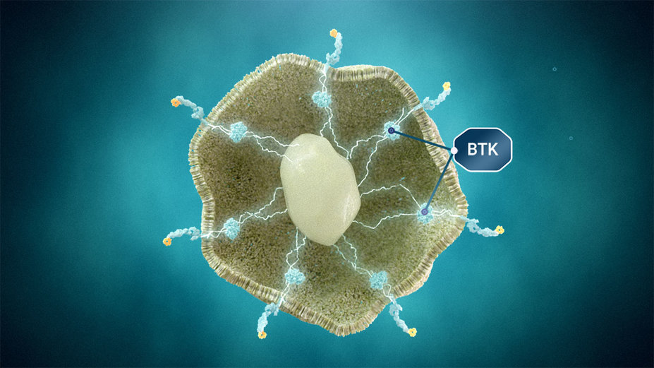 Illustration showing overexpression of BTK in autoimmune B cells.