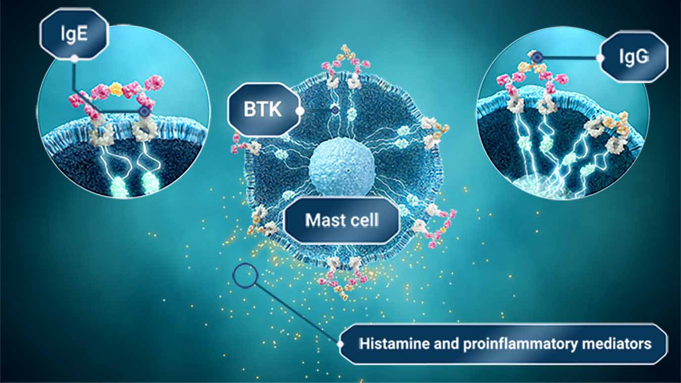 Illustration showing mast cells with BTK, IgE, igG and histamine and proinflammatory mediators.