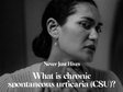 Chronic Hives fact sheet