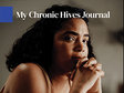 Chronic hives journal